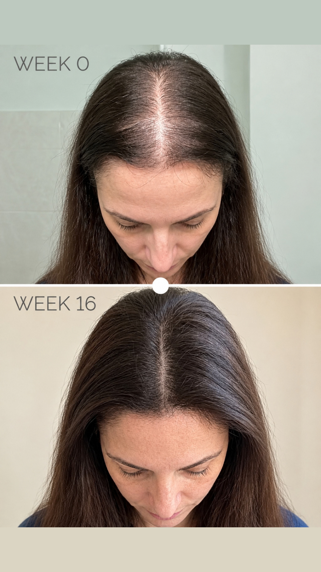 Crown One™ Clinical Laser & Red Light Therapy Hair Regrowth Cap